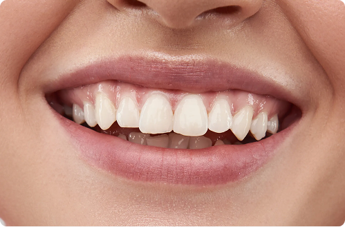 Vos besoins Dentistes à Cagnes-sur-Mer, Drs Payam & Pegah Gandjidadeh
