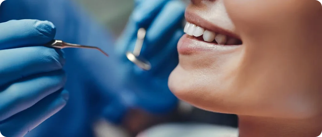 consultation all on cagnes sur mer resultat All-on-4 / All-on-6 Dentiste à Cagnes-sur-Mer | Dr Payam Gandjizadeh