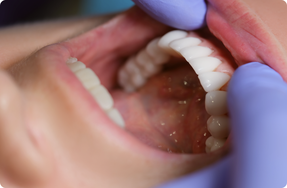 Vos besoins Dentistes à Cagnes-sur-Mer, Drs Payam & Pegah Gandjidadeh