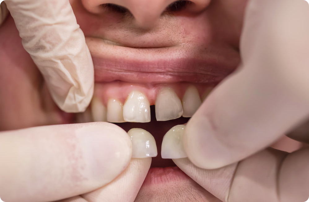 Vos besoins Dentistes à Cagnes-sur-Mer, Drs Payam & Pegah Gandjidadeh