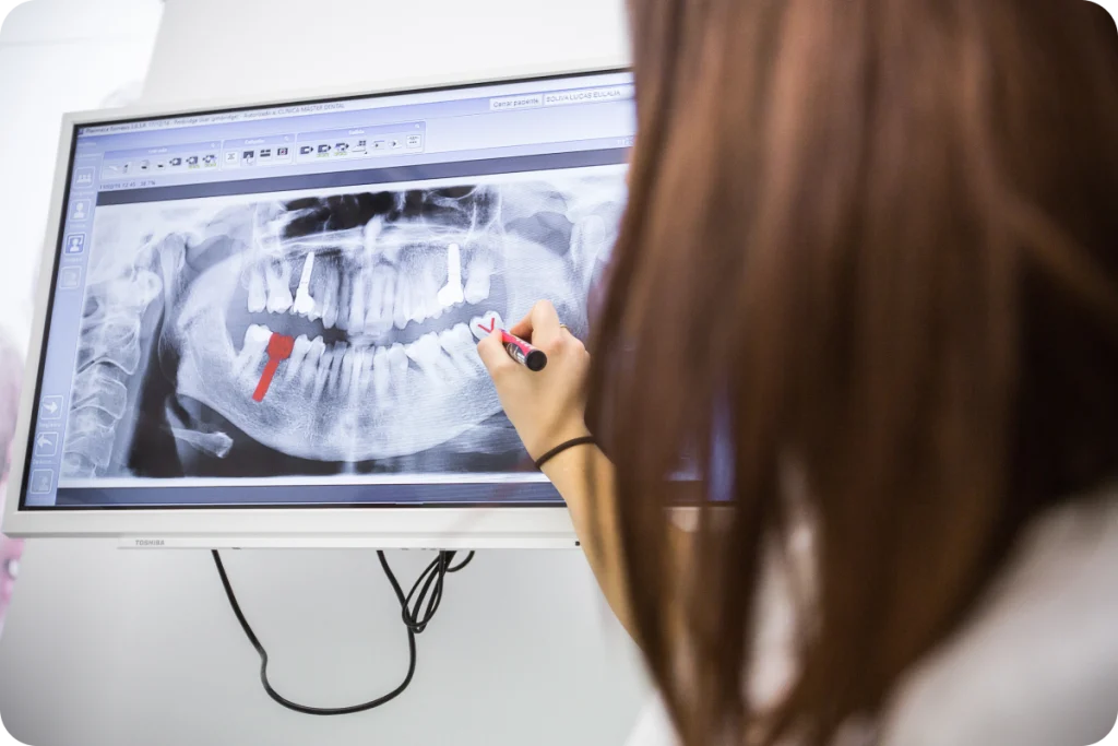 Implant dentaire à Villeneuve-Loubet Dentiste à Cagnes-sur-Mer | Dr Payam Gandjizadeh