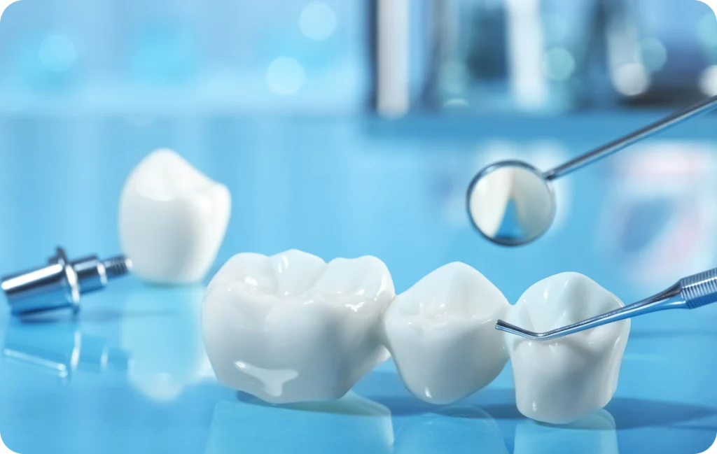 couronnes cagnes sur mer durabilite Couronnes Dentiste à Cagnes-sur-Mer | Dr Payam Gandjizadeh
