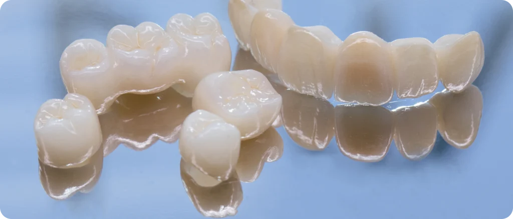 couronnes cagnes sur mer esthetique Couronnes Dentiste à Cagnes-sur-Mer | Dr Payam Gandjizadeh