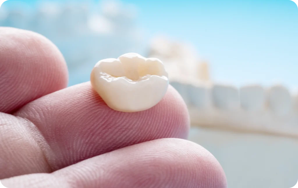 couronnes cagnes sur mer protection Couronnes Dentiste à Cagnes-sur-Mer | Dr Payam Gandjizadeh