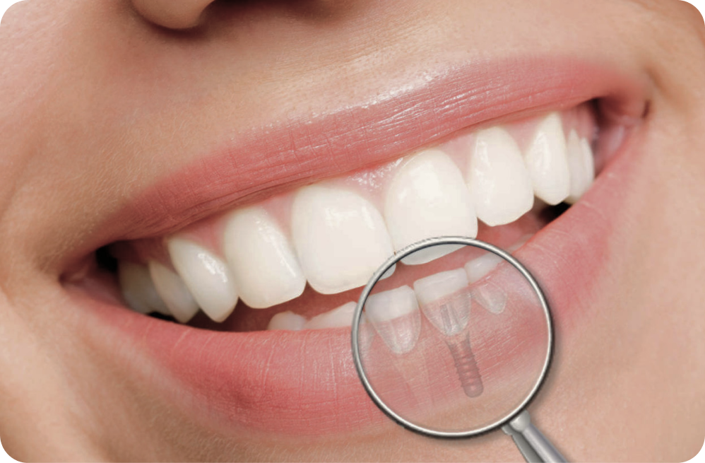 Vos besoins Dentistes à Cagnes-sur-Mer, Drs Payam & Pegah Gandjidadeh