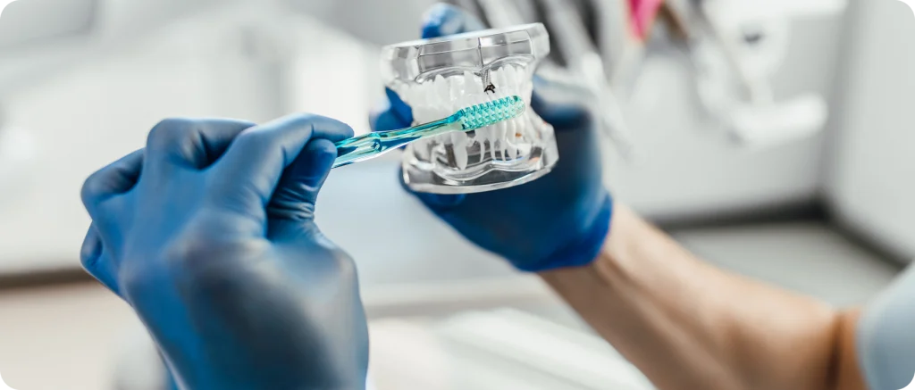 Facette dentaire Dentiste à Cagnes-sur-Mer | Dr Payam Gandjizadeh