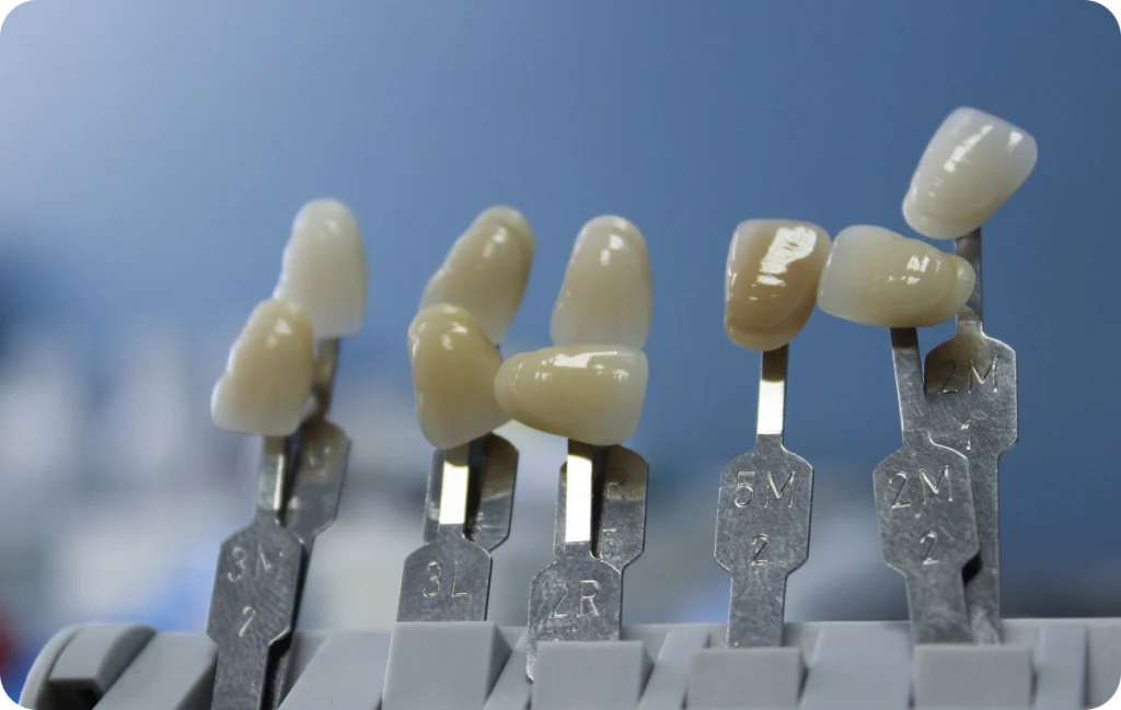 Facette dentaire Dentiste à Cagnes-sur-Mer | Dr Payam Gandjizadeh