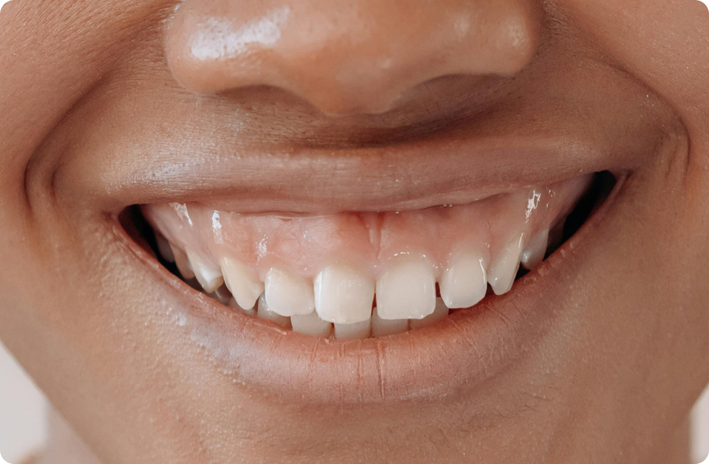 Vos besoins Dentistes à Cagnes-sur-Mer, Drs Payam & Pegah Gandjidadeh