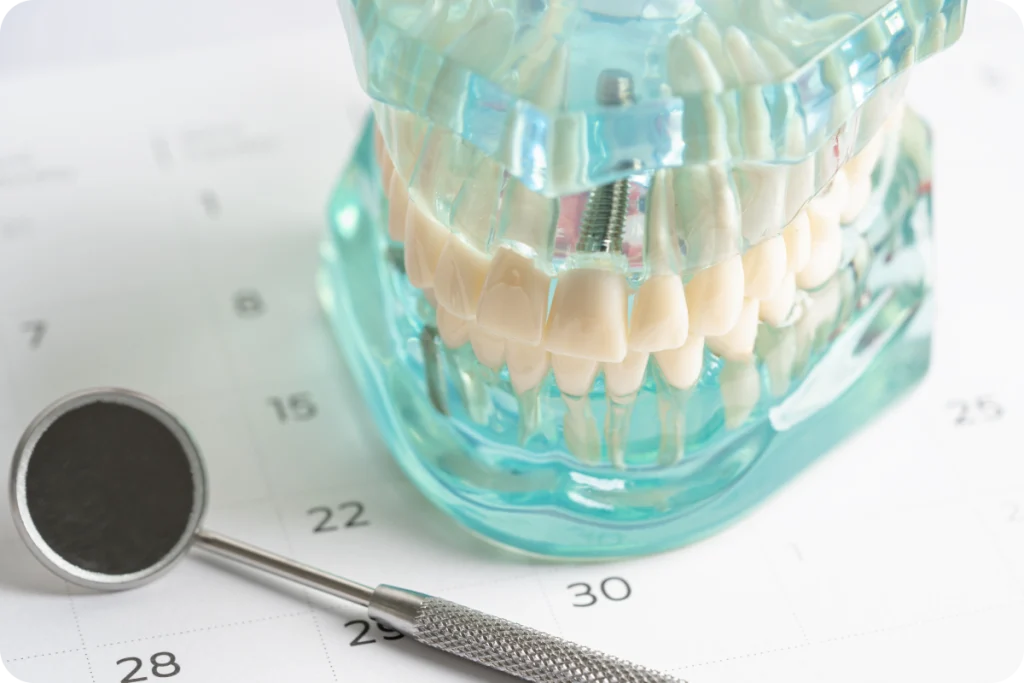 Implant dentaire à Vence Dentiste à Cagnes-sur-Mer | Dr Payam Gandjizadeh