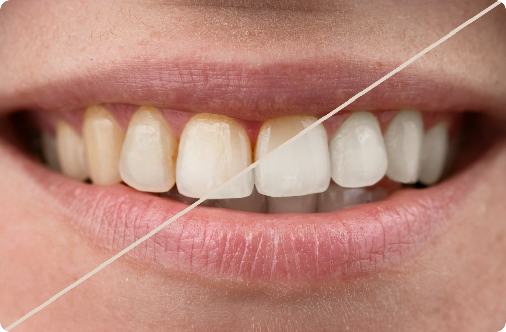 Vos besoins Dentistes à Cagnes-sur-Mer, Drs Payam & Pegah Gandjidadeh