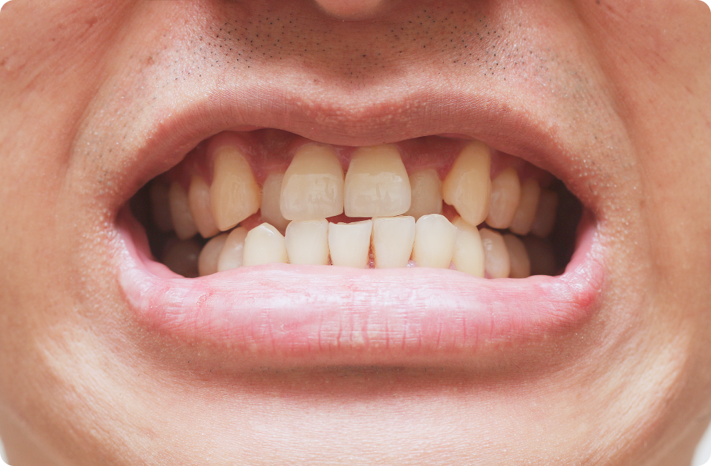Vos besoins Dentistes à Cagnes-sur-Mer, Drs Payam & Pegah Gandjidadeh