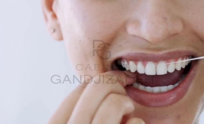 Nos vidéos Dentistes à Cagnes-sur-Mer | Drs Payam & Pegah Gandjizadeh