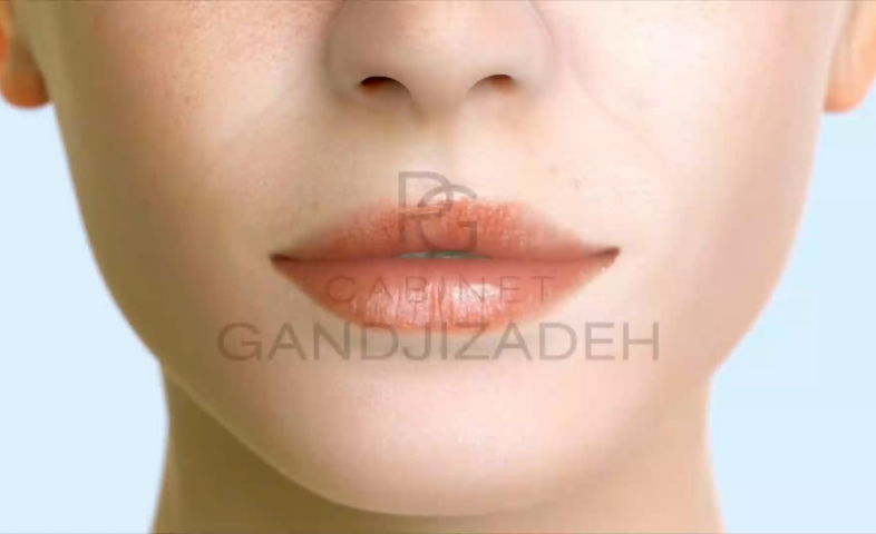 Nos vidéos Dentistes à Cagnes-sur-Mer | Drs Payam & Pegah Gandjizadeh